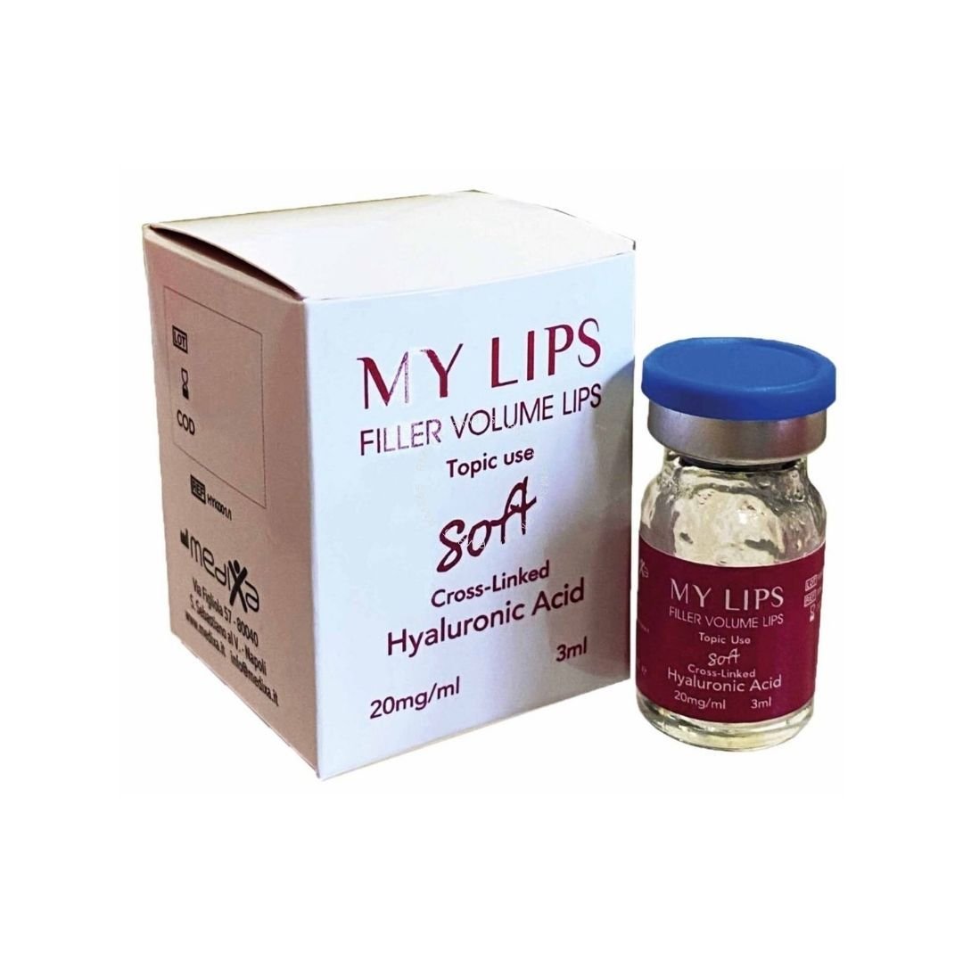 My Lips Soft Filler (1 x 3ml)